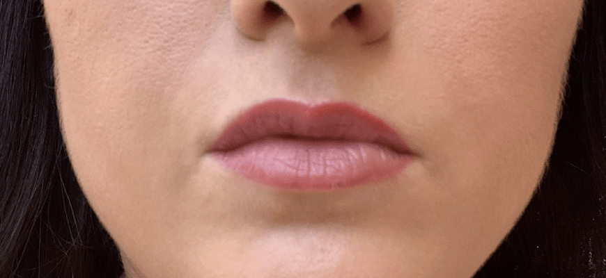 full lips