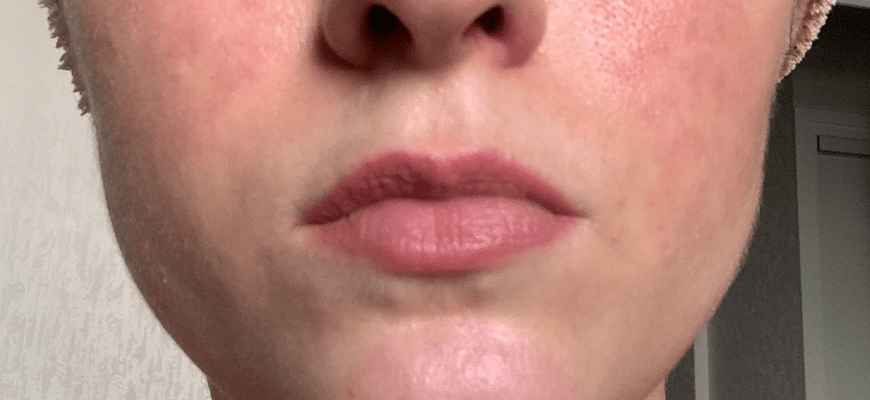 full lips